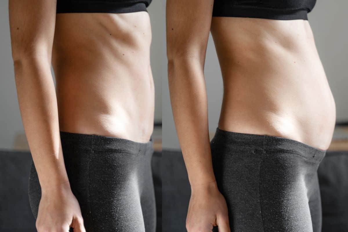 How long does diastasis recti take to improve Falkirk?