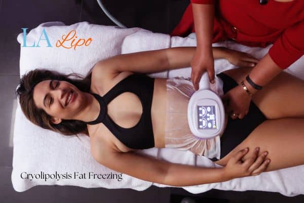 woman getting cryolipolysis Falkirk