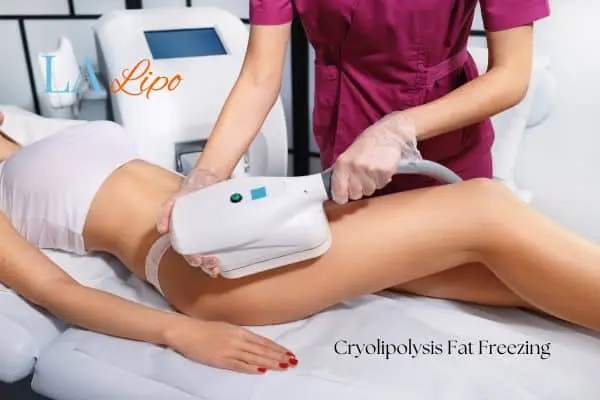 Woman receiving coolsculpting Falkirk treatment on her thighs