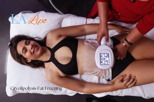 woman getting cryolipolysis Falkirk