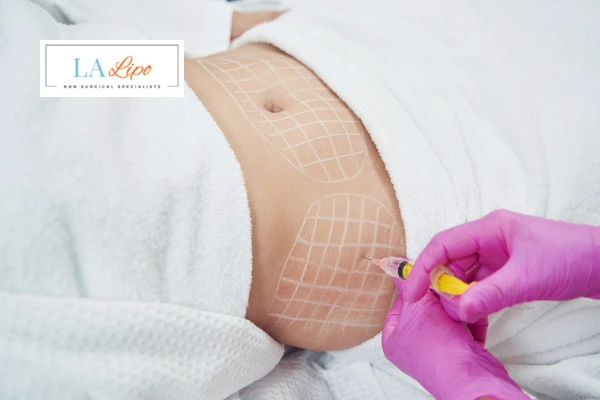 aqualyx fat dissolving injections Falkirk