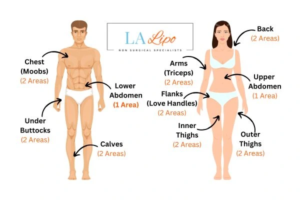 LA LIPO Cryolipolysis Areas Falkirk