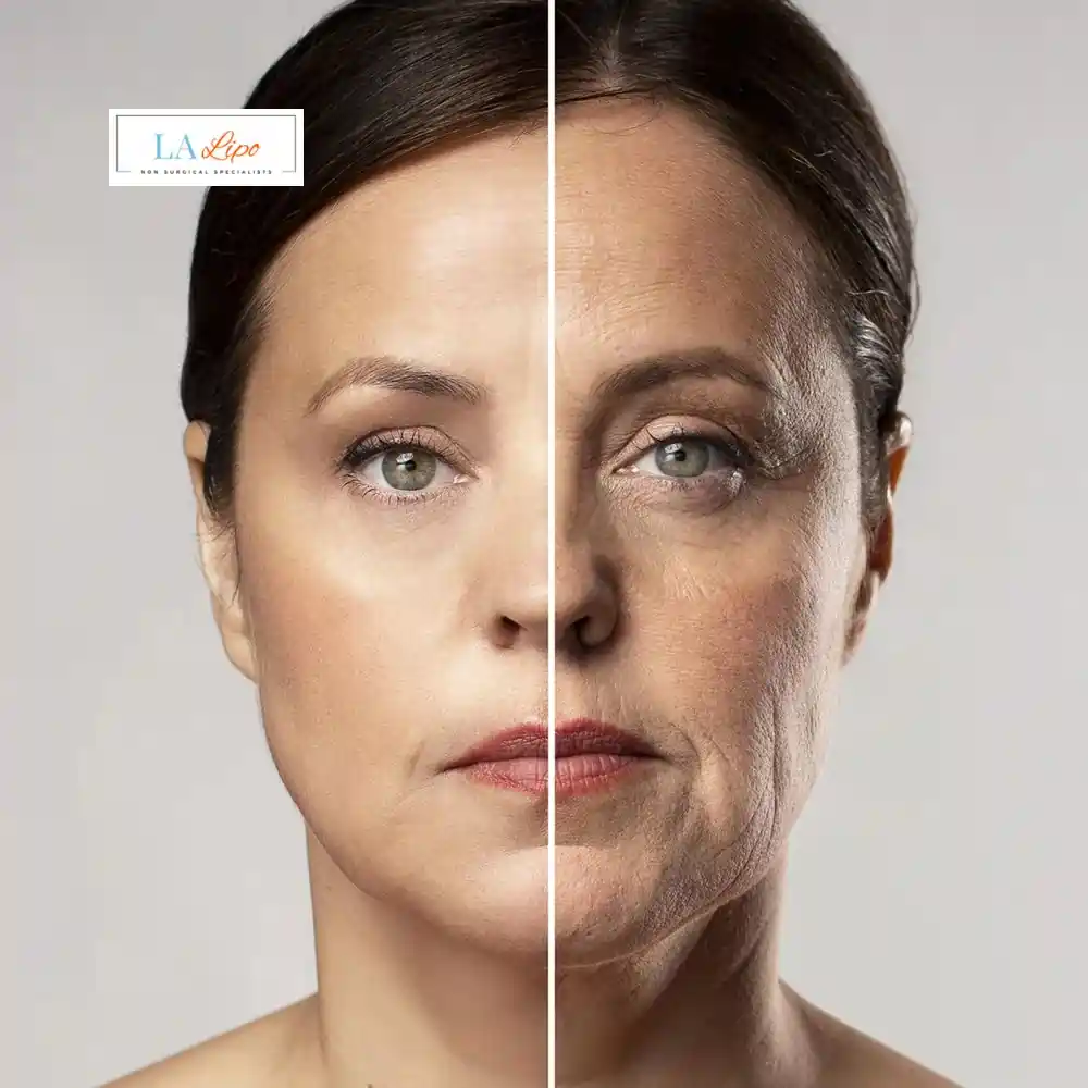 How Can You Tell If Non-Surgical Skin Tightening Is Right for You Falkirk?