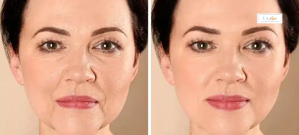 How Long Does It Take to See Results and How Long Do They Last Falkirk?