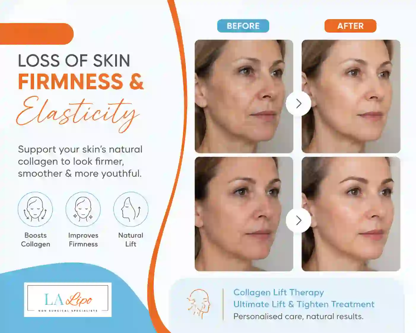 Sign #7: Loss of Skin Firmness and Elasticity Falkirk