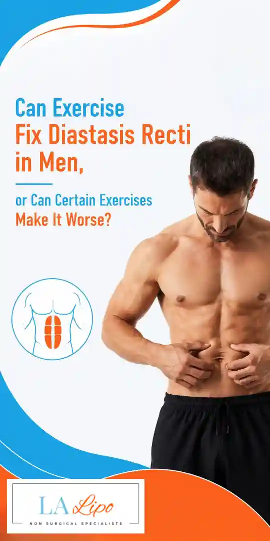 Can Exercise Fix Diastasis Recti in Men, or Can Certain Exercises Make It Worse Falkirk?